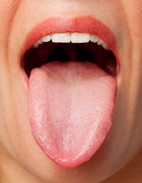 Недостаток витаминов и минералов как фактор появления язвочек во рту